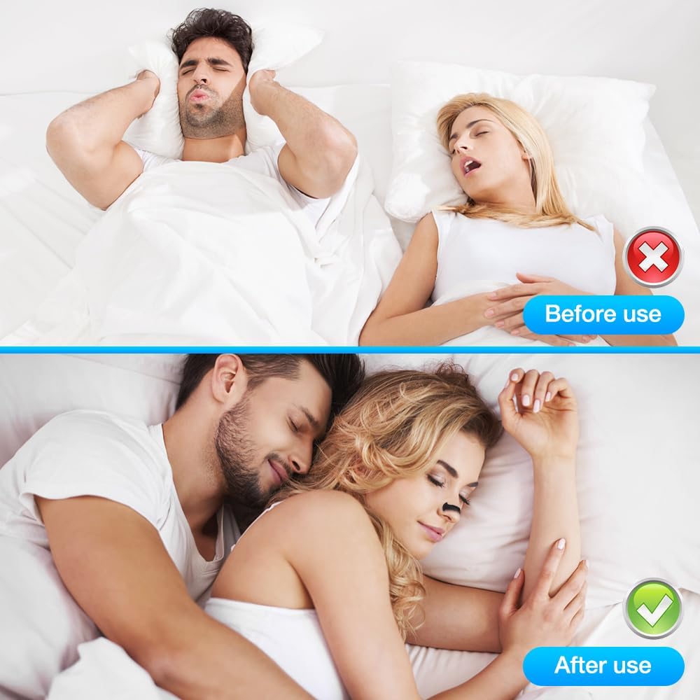 Newyuo™MintakeBreathing MagneticNasal strip Starter Kit