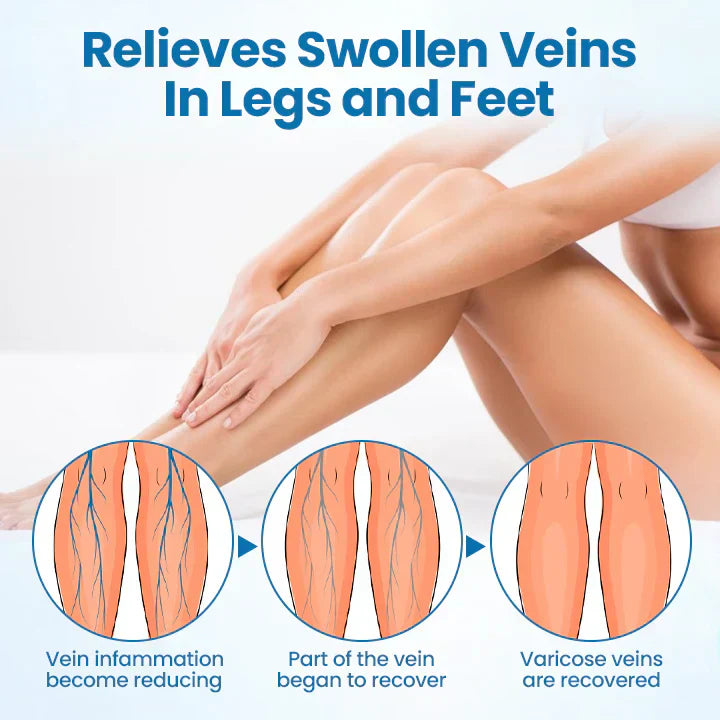 AQA® VeinGuard Herbal Spray-✅ Clinically proven to eliminate varicose veins in just 7 days!