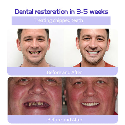 🔥 Final Day 60% OFF 🔥BBOJI™- Fluoride-Free Hydroxyapatite Toothpaste