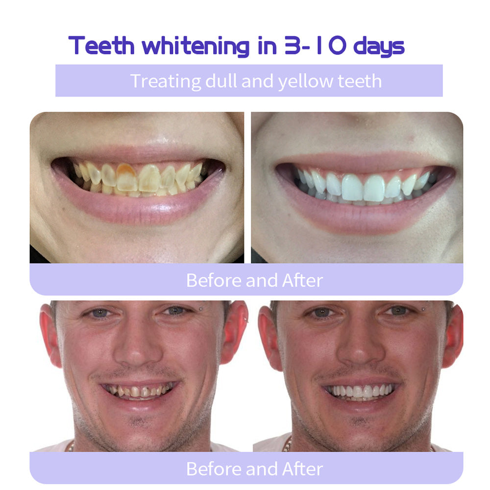 🔥 Final Day 60% OFF 🔥BBOJI™- Fluoride-Free Hydroxyapatite Toothpaste