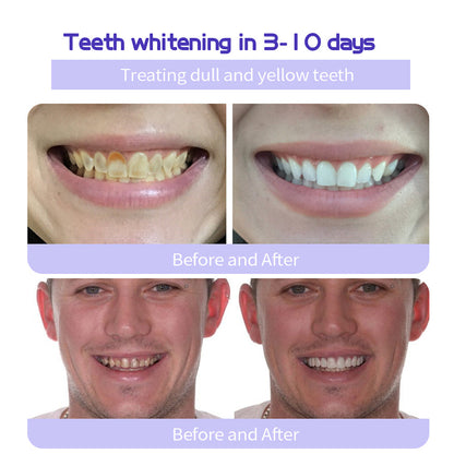 🔥 Final Day 60% OFF 🔥BBOJI™- Fluoride-Free Hydroxyapatite Toothpaste